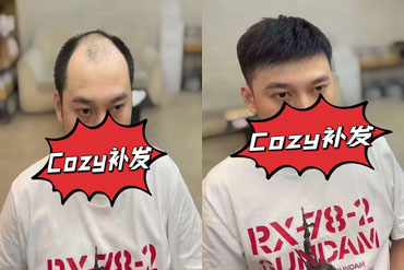 大庆兄弟织发补发后说这钱花的太值了