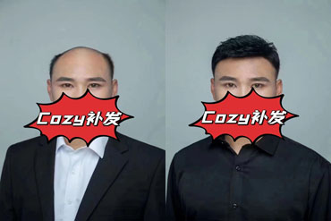 盘锦小哥织发补发后高兴的开怀大笑