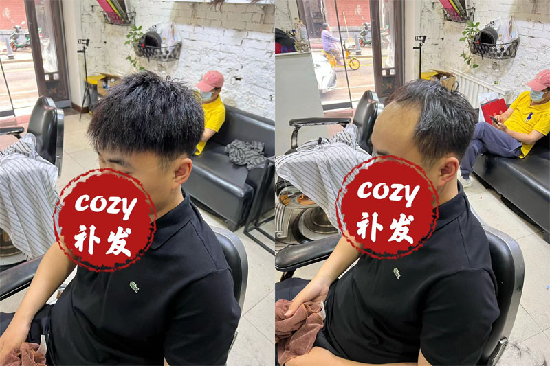 沈阳小弟定制无痕补发后回到年少时的帅气