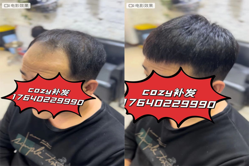 武汉小伙来cozy沈阳盛源定制的无痕补发