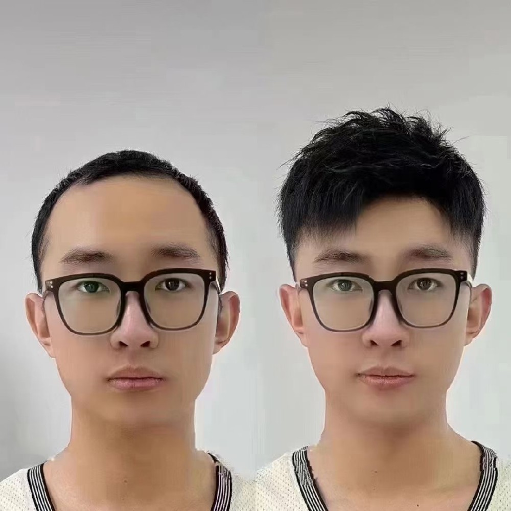 沈阳补发假发案例
